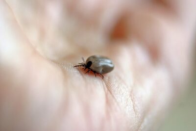 Tick on a person's hand